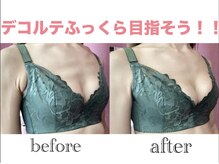 カピリナ(KA PILINA)/施術1回目のフィッティング