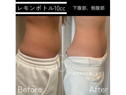 ベル(BELLE)の写真