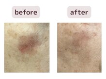 リジェネラティブセル メディカルサロン(Regenerative Cell Medical Salon)/ビフォーアフター