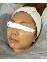 ソアン(Soin)/ツヤ肌☆スキングロウマスク