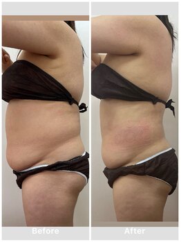 ルミナス/CAVI -CRYO PRO の凄さ！