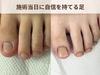 ブルームーンネイルズ(BLOOMOON.nails)/