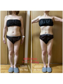 フィカス(FICUS)/結果重視のダイエットコース