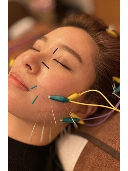 ハリキュア(Hari-Cure)/凄い効果のW電気鍼！！