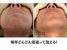 ロココ 山口店(Lococo)/男性のお客様は吉敷へ