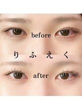 フォーヴリュンヌ(FOVLUNE)/ラッシュリフトとマツエク