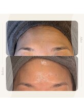 キュレイテッドスキン(CURATED SKIN)