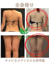 リシャイン(Reshine)/ブライダルダイエット