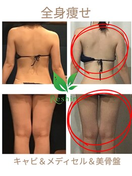 リシャイン(Reshine)/ブライダルダイエット