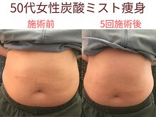 整体リラクゼーション パステル-I/炭酸ミスト痩身/正面