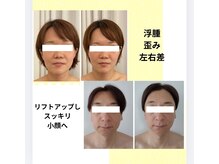 アール(R)の雰囲気（人気No.1　小顔コルギは女性、男性にも対応しております。）