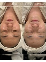 スア ビューティースタジオ(Sua BEAUTYSTUDIO)/陶肌×韓国LED肌管理