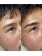オーブハウス(aube house)の写真/骨格に合わせた眉へ。アイブロウワックスで自然な眉をご提案。メンズ・学生さんもワックス脱毛で垢抜け眉へ
