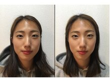 大塚さくら整体院/小顔整体ビフォーアフター♪