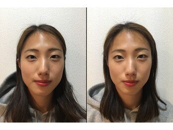 大塚さくら整体院/小顔整体ビフォーアフター♪