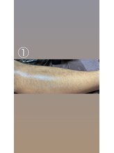 エステサロン桜/半ズボンからのちらり…（汗）