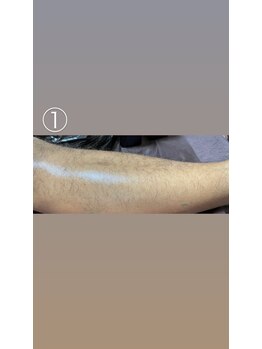 エステサロン桜/半ズボンからのちらり…（汗）