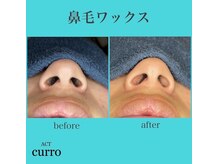 アクト クロ(ACT curro)/【鼻毛ワックス】施術例