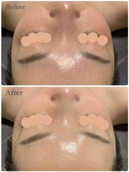 ラグ(LUXU)/徹底美白♪