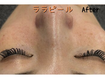 ダイヤモンド リーエンダ(Diamond leende)/ララピール