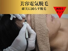 ベルアンドヘルス 千葉(BELL&HEALTH)/美容電気脱毛★唯一無二の脱毛