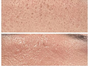 トータルビューティ リライフ(Total beauty Relife)/ハーブ光フェイシャル