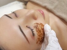 リリーベル 新宿歌舞伎町(Lily Belle)/ニキビケアにも◎