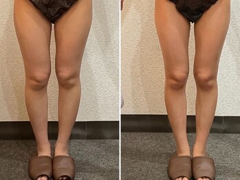 美容整体ウェリナ 中川八田院/小顔矯正/骨盤矯正/痩身整体