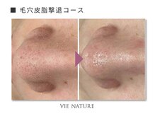 ヴィナチュール(vie nature)/■毛穴ケア
