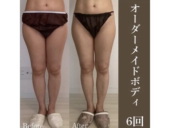 サロンドペシェ(salon de peche)/30代*オーダーメイドボディ6回