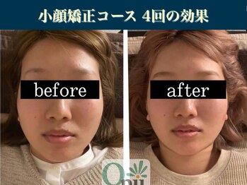 キュープ 表参道店(Qpu)/継続が「小顔」と「美」をつくる