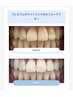 美容ホワイトニング回数券ご利用の方はこちら