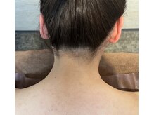 リリ(RiRi)/【脱毛】うなじ脱毛