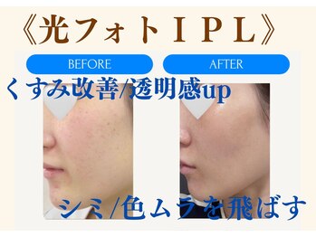 ムーンライズ(moonrise)/