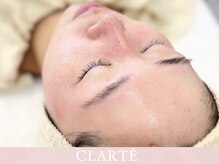 クラルテ(CLARTE)/自信が持てる艶肌に導きます！