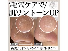 リアン(Riant)/毛穴ケアコース 