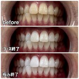 ティースペース 蒲郡店(T-space)