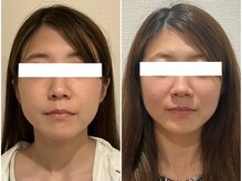 美容整体ウェリナ あま甚目寺院/小顔矯正/骨盤矯正/美脚サロン