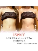 エスプリ 新宿店/レモンボトル×シェイプスリム