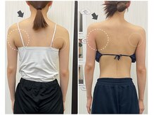 ステイゴールド美容整体院(STAY GOLD)の雰囲気（脇肉・猫背・肩のもっこりも変化します◎ブライダルの方に人気♪）