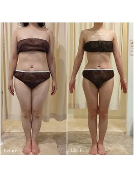 ルノン(Lunon)/《全身痩》燃焼フォースカッター