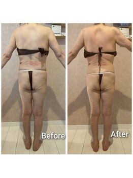 エミア(Emia)/全身痩せ×歪み改善◎120分 １回