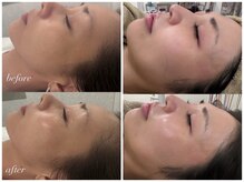 マホロバ(mahoroba)の雰囲気（美容鍼＋お肌管理が人気★！お身体のメンテもセットで根本改善）