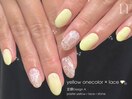 定額A｜イエロー×レース