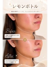 ブリリアントスマイル/与那原レモンボトル