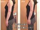 リフレッシュサロン シュクレ(Sucre)の写真