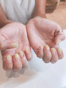 アールエム(Rm)/蛍光イエロー