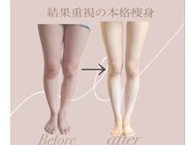 ヨサパーク ココ(YOSA PARK COCO)の雰囲気（どのくらいサイズダウンしたいですか？短期間で結果を実感！）