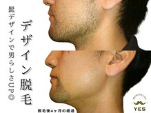 イエス 東京池袋店(YES)の雰囲気（痛みの少ないメンズ脱毛★ヒゲ脱毛/全身脱毛/VIO/シェービング）