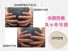 ミラ(Mira...)/☆Before→After☆